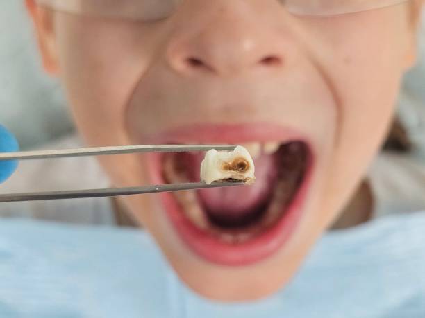 Best Walk-In Emergency Dentist in Ballinger, TX